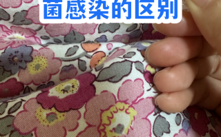  小孩感冒是病毒感染严重还是细菌感染严重(细菌感染一般几天自愈)