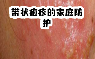  最近流行病毒什么病什么症状都没有(中国又出现一种新病毒)