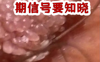  高危病毒感染有什么症状(艾滋病阻断药多久有效)