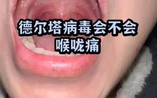  疫情变异成什么样子了(变异的痣什么样子)
