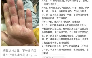  疫情过后心理问题有哪些表现和症状(疫情过后的心理问题)