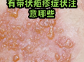 最近出现的病毒都有什么症状(最近出现的病毒叫什么名字)