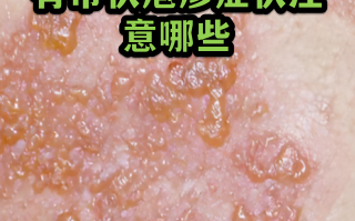  最近出现的病毒都有什么症状(最近出现的病毒叫什么名字)
