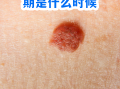  最近病毒高发期是哪个病毒一月几次了啊(2020现在什么病毒高发期)