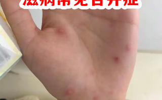  女性巨细胞病毒是什么引起的(女性巨细胞病毒是什么引起的原因)