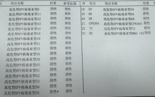  高危型56阳性很严重吗(高危型56阳性怎么感染的)
