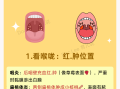  什么病毒嗓子疼不发烧不咳嗽(什么病毒嗓子疼不发烧不咳嗽呢)