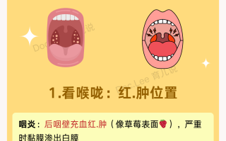  什么病毒嗓子疼不发烧不咳嗽(什么病毒嗓子疼不发烧不咳嗽呢)
