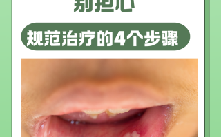  疫情怎么能控制(疫情的原因是什么引起的)