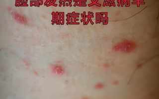  最近病毒的情况有哪些症状呢(常见疾病预防ppt)