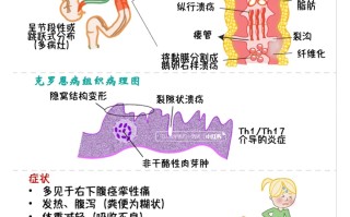  最近有什么病毒导致拉肚子的症状呢(最近流行的病毒拉肚子2020)