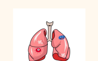  新冠肺炎属于瘟疫还是病毒(新型冠状病毒性肺炎属于瘟疫吗)