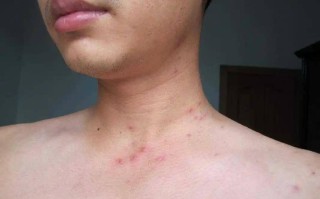  疫情的症状表现有哪些呢(疫情的症状是怎么样的)