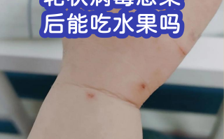  现在什么水果有病毒(什么水果有新型冠状病毒)