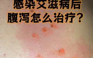  疫情的症状是啥样的(最近疫情的症状表现有哪些)