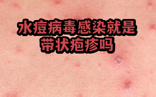  广东的病毒可能有三个来源是什么(广东的病毒叫什么)