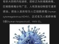  最近出来的病毒叫什么名字啊图片(最近出来的病毒叫什么名字啊图片视频)